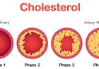 Cholesterol