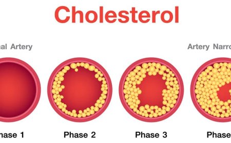 Cholesterol