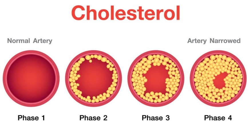 Cholesterol