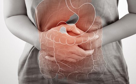 Inflammatory bowel disease- Crohn's disease