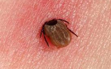 Lyme Disease