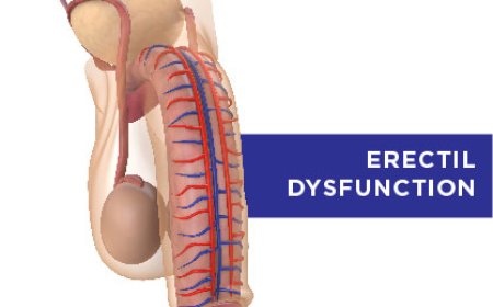 Impotence (Erectile dysfunction)