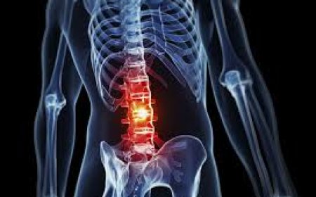 Low Back Pain Deciding About MRI