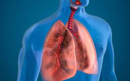 Lung Diseases (Respiratory Problems)