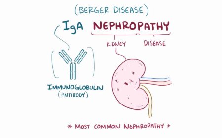 IgA Nephropathy