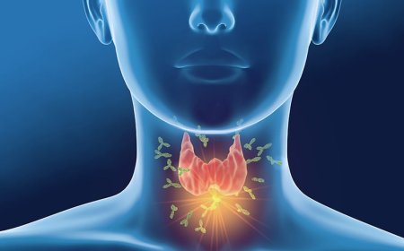 Hashimoto's Thyroiditis
