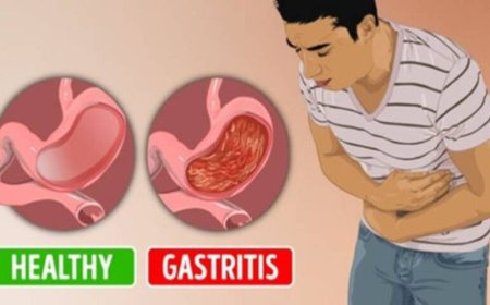 Gastritis