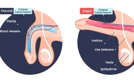 Erectile Dysfunction