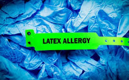 Latex allergy