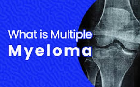 Multiple Myeloma