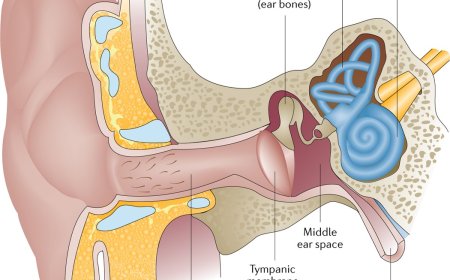 Otitis media