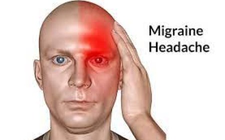 Migraine Headache