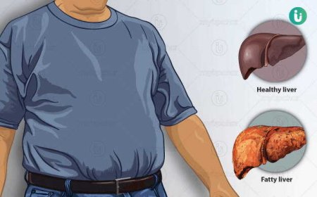 Non Alchoholic Fatty Liver Disesase