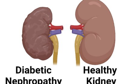 Nephropathy Diabetic