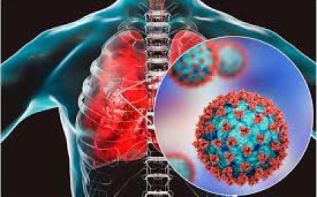 SARS (Severe Acute Respiratory Syndrome)