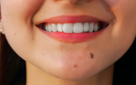 Moles,Skin Tags,Freckles,lentigo,Seborrhic keratosis