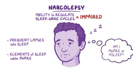 Narcolepsy