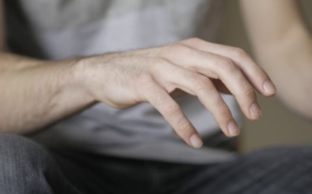 Presenile Tremor Syndrome