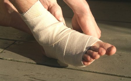 Wrapping of Sprained Ankle