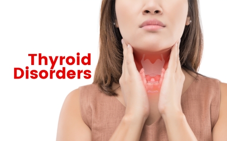 Thyroid Disorders