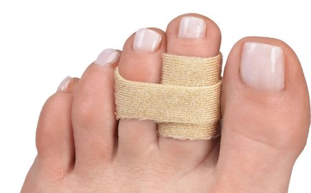 Toe Fracture - Broken Toe