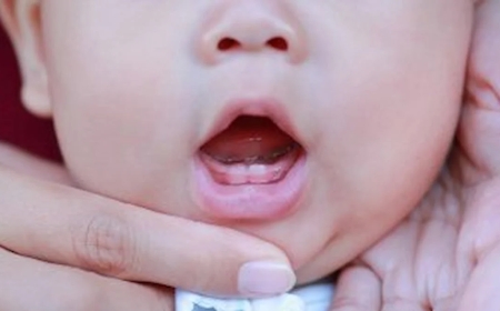 Teething