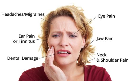 Temporomandibular (TM) Disorders