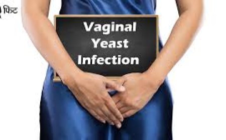 Vaginal yeast infections