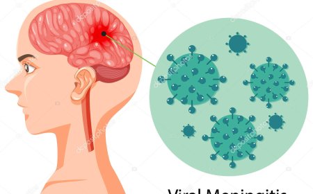 Viral meningitis