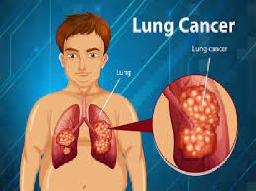 Lung Cancer