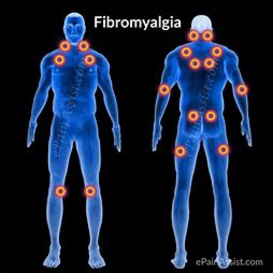 Fibromyalgia