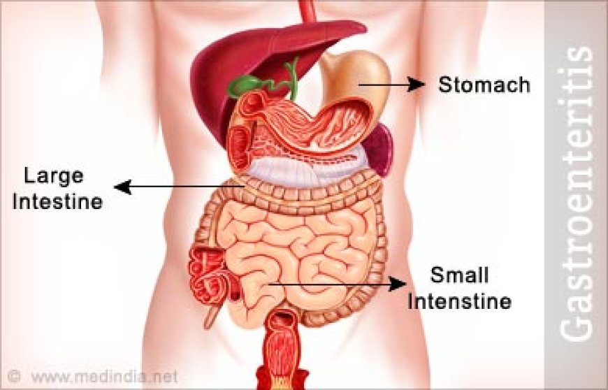 Gastroenteritis