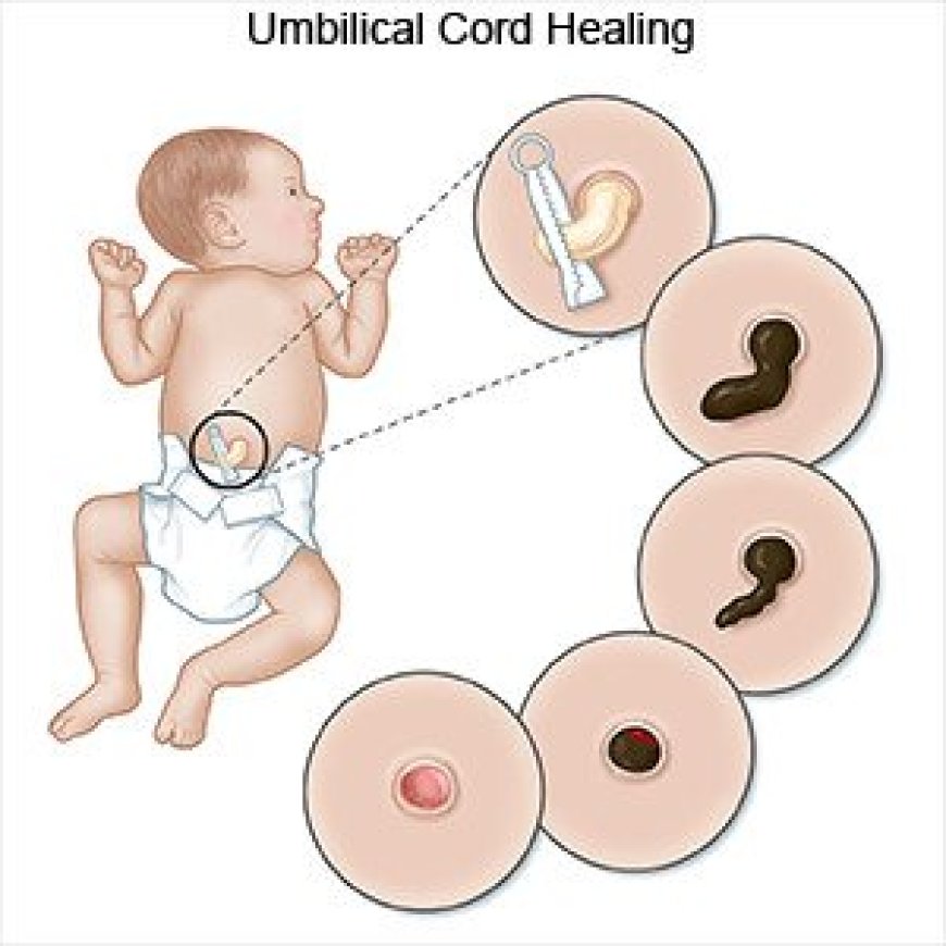 Umbilica Cord Care