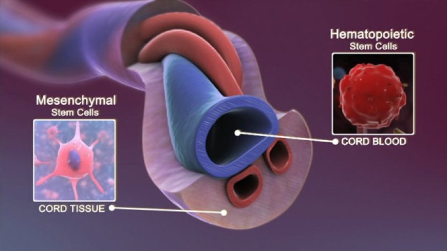 Umbilical Cord Blood Stem Cells