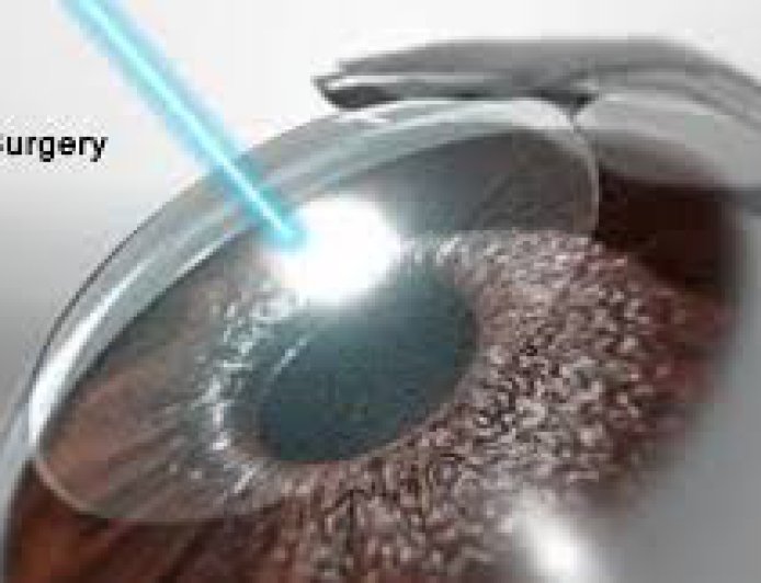 LASIK vs LASEK vs PRK – Understanding the Options  for Clearer Vision